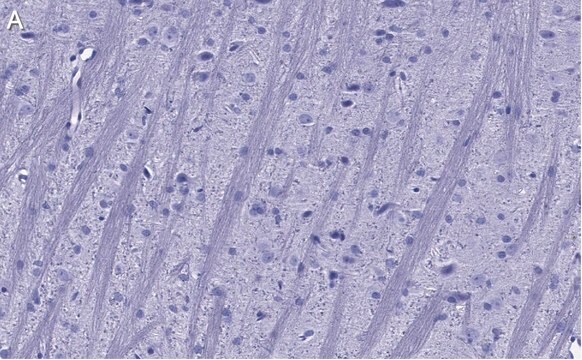 抗シナプトフィジン抗体 クローン1G7 ZooMAb&#174; ウサギ・モノクローナル recombinant, expressed in HEK 293 cells