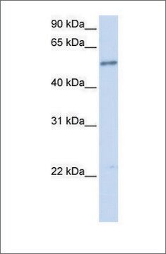 抗IL1RL1 ウサギ宿主抗体 affinity isolated antibody