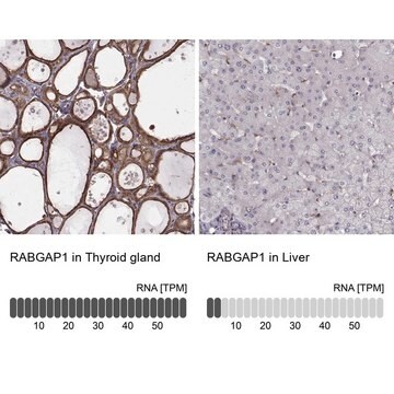 Anty-RABGAP1 Prestige Antibodies&#174; Powered by Atlas Antibodies, affinity isolated antibody