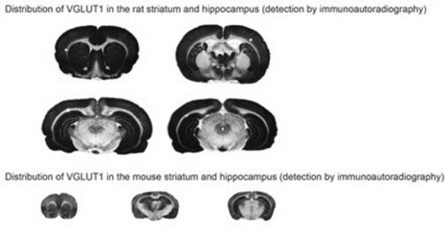 Anti-VGluT1 from rabbit