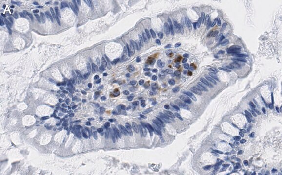 抗インターフェロン&#946;抗体 クローン4F5 ZooMAb&#174;ウサギモノクローナル recombinant, expressed in HEK 293 cells