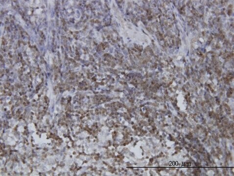 ANTI-STAT5B antibody produced in mouse clone 2D1, purified immunoglobulin, buffered aqueous solution