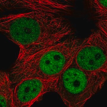 Anti-RNF168 antibody produced in rabbit Prestige Antibodies&#174; Powered by Atlas Antibodies, affinity isolated antibody