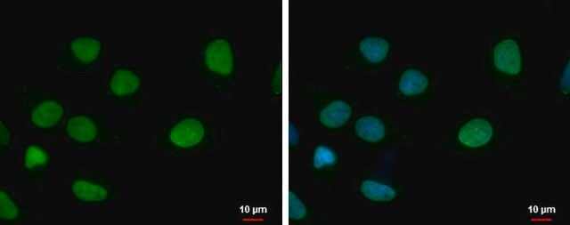 Monoclonal Anti-ELP3 antibody produced in mouse clone GT11811, affinity isolated antibody