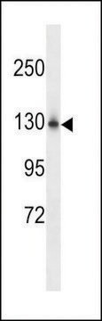 ANTI-NCKPL (CENTER) antibody produced in rabbit affinity isolated antibody, buffered aqueous solution