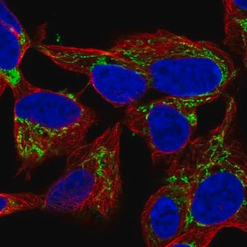 Anti-NME4 antibody produced in rabbit Prestige Antibodies&#174; Powered by Atlas Antibodies, affinity isolated antibody