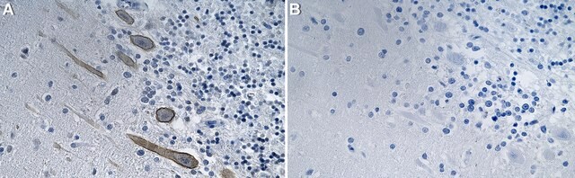 Anti-p-PKC&#947; (Thr514) Antibody, clone 4F20 ZooMAb&#174; Rabbit Monoclonal recombinant, expressed in HEK 293 cells