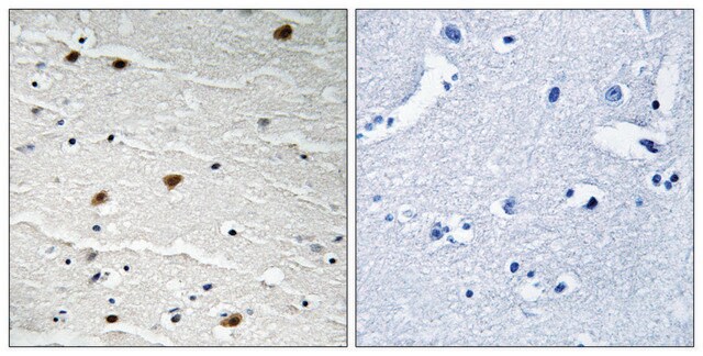 Anti-AKT1 antibody produced in rabbit affinity isolated antibody