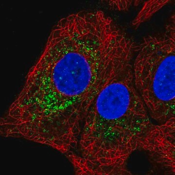 Anti-GGT1 antibody produced in rabbit Prestige Antibodies&#174; Powered by Atlas Antibodies, affinity isolated antibody