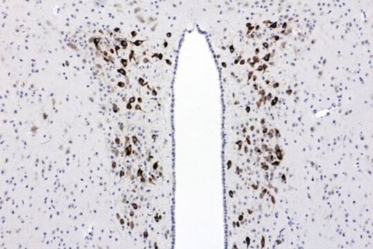 Anti-CTHRC1-Antikörper, Klon&nbsp;Vli-55 clone Vli-55, from rabbit