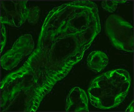 Anti-Cytokeratin Peptide 18 antibody, Mouse monoclonal clone CY-90, purified from hybridoma cell culture