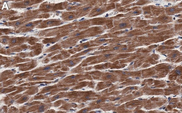 Anti-AGK Antibody, clone 1F21 ZooMAb&#174; Rabbit Monoclonal recombinant, expressed in HEK 293 cells