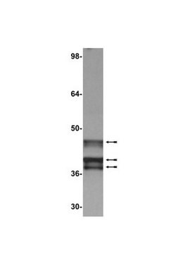 Anticuerpo anti-E1A (Ad2/ Ad5), clon M73 clone M73, Upstate&#174;, from mouse