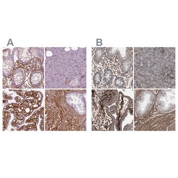 Anti-COL6A2 antibody produced in rabbit Prestige Antibodies&#174; Powered by Atlas Antibodies, affinity isolated antibody