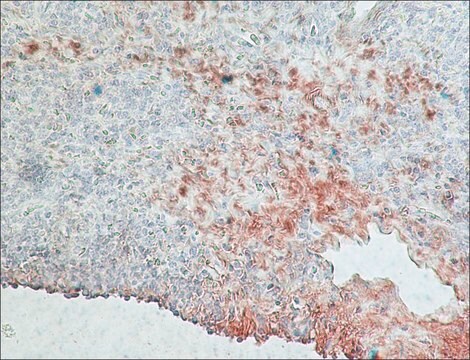 Monoclonal Anti-Rabbit Immunoglobulins–Peroxidase antibody produced in mouse clone RG-16, purified immunoglobulin, lyophilized powder