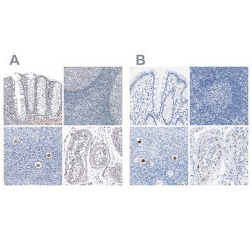 抗SALL4抗体 ウサギ宿主抗体 Prestige Antibodies&#174; Powered by Atlas Antibodies, affinity isolated antibody, buffered aqueous glycerol solution