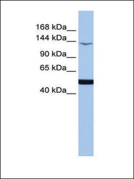 Anti-MAP3K1 antibody produced in rabbit affinity isolated antibody