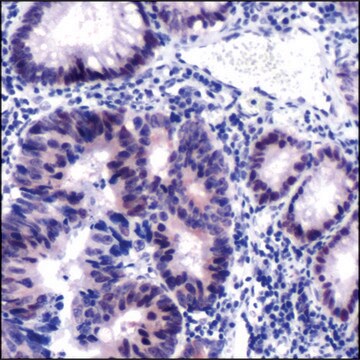 Anti-MSH2 antibody, Rabbit monoclonal clone SP46, recombinant, expressed in proprietary host, affinity isolated antibody