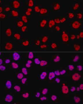 Anti-METTL3 antibody produced in rabbit