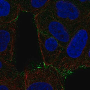 Anti-Sptlc2 Antibody Produced In Rabbit Prestige Antibodies&#174; Powered by Atlas Antibodies, affinity isolated antibody, buffered aqueous glycerol solution