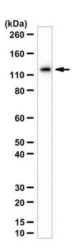 Anticuerpo anti-beta galactosidasa de E. coli from chicken, purified by affinity chromatography