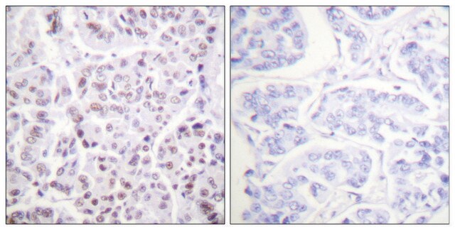 Anti-Histone H4 (Acetyl-Lys5) antibody produced in rabbit affinity isolated antibody