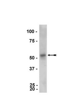 Anticorps anti-Parkin, clone&nbsp;PRK8 ascites fluid, clone PRK8, Upstate&#174;