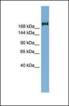 抗-TMEM2 兔抗 affinity isolated antibody