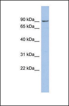 Anti-NPHP1 antibody produced in rabbit affinity isolated antibody