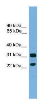 Anti-CD8B antibody produced in rabbit affinity isolated antibody