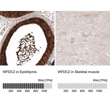 Anti-WFDC2 antibody produced in mouse Prestige Antibodies&#174; Powered by Atlas Antibodies, clone CL12886, purified by using Protein A, buffered aqueous glycerol solution