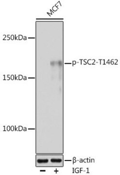 Anti-Phospho-TSC2-T1462 antibody produced in rabbit