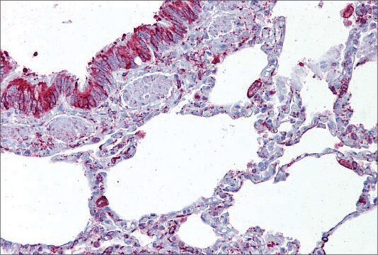 抗GABRB3抗体 ウサギ宿主抗体 affinity isolated antibody