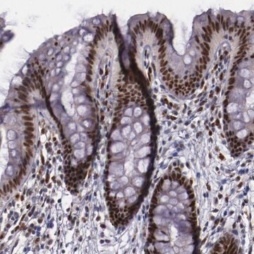 Anti-CHEK2 antibody produced in rabbit Prestige Antibodies&#174; Powered by Atlas Antibodies, affinity isolated antibody, buffered aqueous glycerol solution