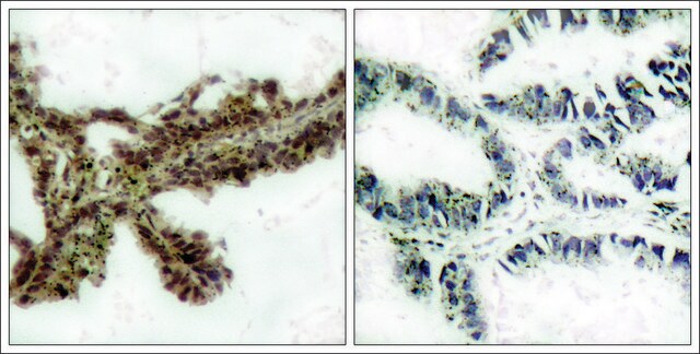 Anti-phospho-AKT1 (pThr308) antibody produced in rabbit affinity isolated antibody