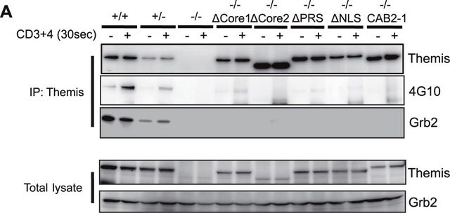 Anticuerpo anticuerpo anti-Themis from rabbit, purified by affinity chromatography