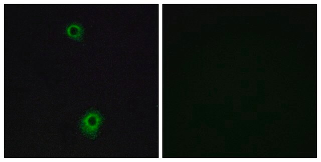 抗-HTR1B 兔抗 affinity isolated antibody