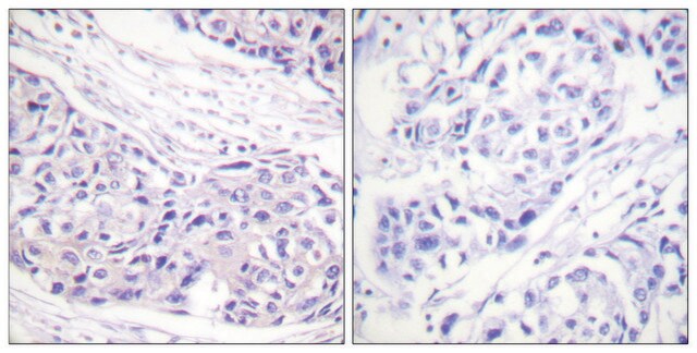 Anti-p90 RSK antibody produced in rabbit affinity isolated antibody