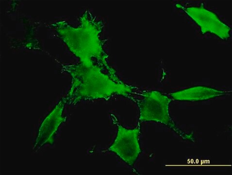 Monoclonal Anti-PAK3 antibody produced in mouse clone 3A12, purified immunoglobulin, buffered aqueous solution