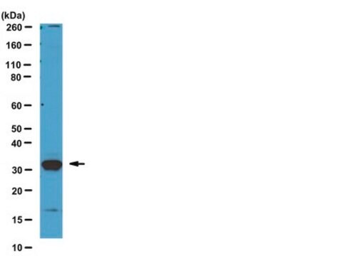 Anti-Kallikrein-3 (KLK3) (CT) Antibody from rabbit