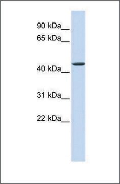 Anti-JMJD4 antibody produced in rabbit affinity isolated antibody