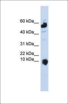 Anti-C1ORF151 antibody produced in rabbit affinity isolated antibody