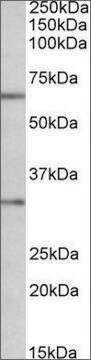 Anti-CASP3 antibody produced in goat affinity isolated antibody, buffered aqueous solution