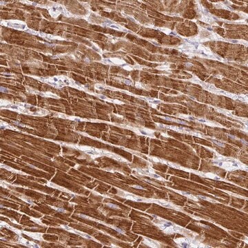 Anti-DAPK1 antibody produced in rabbit Prestige Antibodies&#174; Powered by Atlas Antibodies, affinity isolated antibody, buffered aqueous glycerol solution