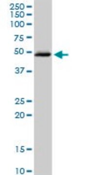 Anti-HSD3B2 antibody produced in rabbit purified immunoglobulin, buffered aqueous solution