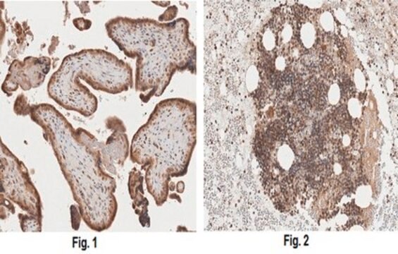 Anti-G-CSF-R/CD114 Antibody, clone 5A11.1 clone 5A11.1, from mouse