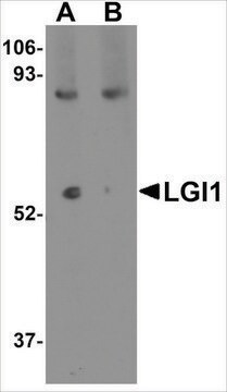 Anti-LGI1 (ab2) antibody produced in rabbit affinity isolated antibody, buffered aqueous solution