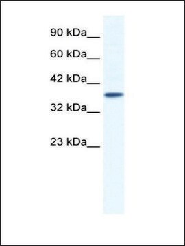 Anti-KCNK3 antibody produced in rabbit IgG fraction of antiserum