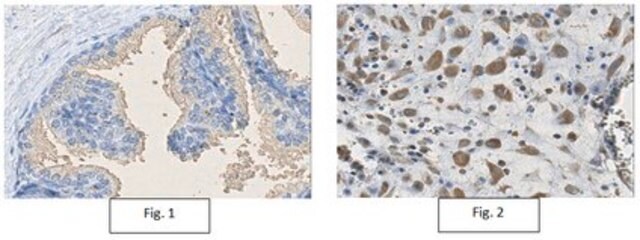 Anti-RIPK2 Antibody, clone 1H10.1 clone 1H10.1, from mouse