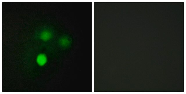 Anti-KNTC2 antibody produced in rabbit affinity isolated antibody